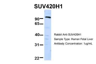 Western Blot: SUV420h1 Antibody [NBP1-78303]