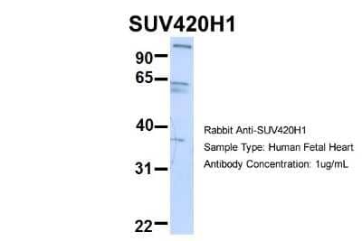 Western Blot: SUV420h1 Antibody [NBP1-78303]