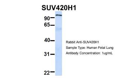 Western Blot: SUV420h1 Antibody [NBP1-78303]