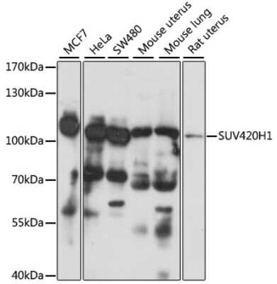 Western Blot: SUV420h1 AntibodyAzide and BSA Free [NBP2-94791]