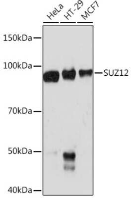 Western Blot: SUZ12 Antibody (1M3V2) [NBP3-16383]