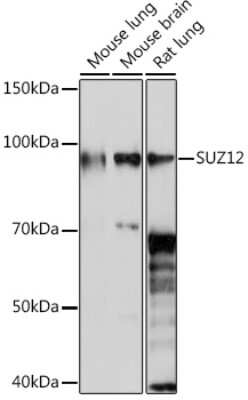 Western Blot: SUZ12 Antibody (1M3V2) [NBP3-16383]