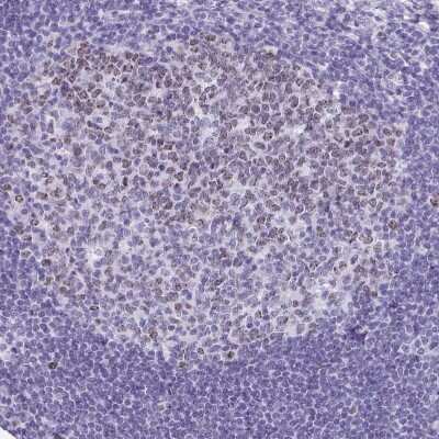 Immunohistochemistry-Paraffin: SUZ12 Antibody [NBP2-33834]