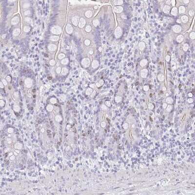 Immunohistochemistry-Paraffin: SUZ12 Antibody [NBP2-33834]