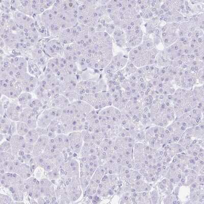 Immunohistochemistry-Paraffin: SUZ12 Antibody [NBP2-33834]