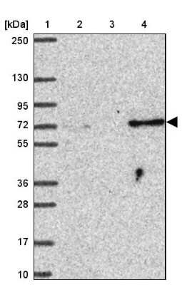 Western Blot: SUZ12 Antibody [NBP2-33834]