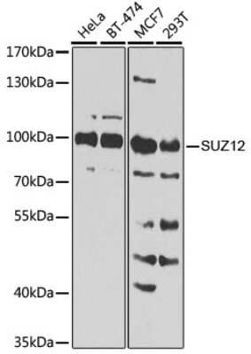 Western Blot: SUZ12 AntibodyBSA Free [NBP3-03738]