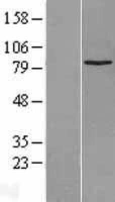 Western Blot: SUZ12 Overexpression Lysate [NBL1-16629]