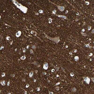 Immunohistochemistry-Paraffin: SV2A Antibody [NBP1-82964]
