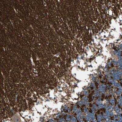 Immunohistochemistry-Paraffin: SV2A Antibody [NBP1-82964]