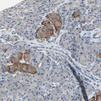 Immunohistochemistry-Paraffin: SV2A Antibody [NBP1-82964]