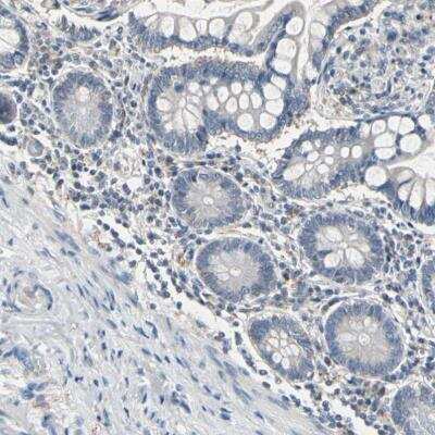 Immunohistochemistry-Paraffin: SV2A Antibody [NBP1-82964]