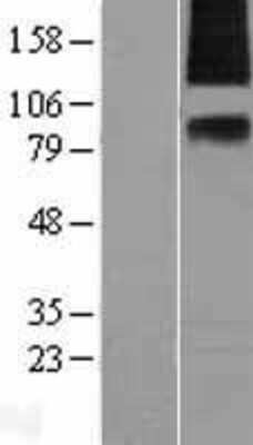 Western Blot: SV2A Overexpression Lysate [NBL1-16630]