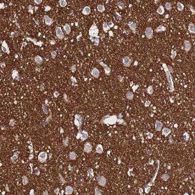 Immunohistochemistry-Paraffin: SV2B Antibody [NBP1-92462]