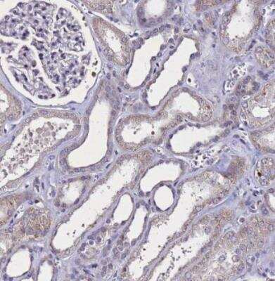 Immunohistochemistry-Paraffin: SV2B Antibody [NBP1-92462]