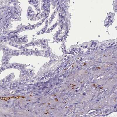 Immunohistochemistry-Paraffin: SV2C Antibody [NBP1-86239]