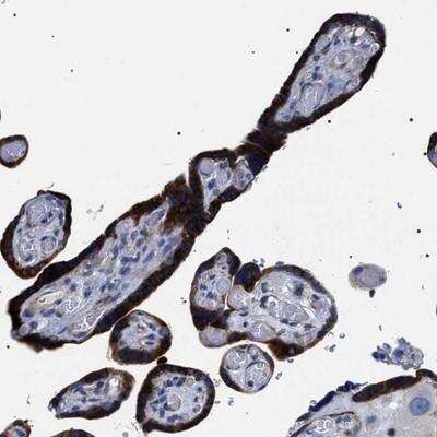 Immunohistochemistry-Paraffin: SVEP1 Antibody [NBP1-90792]