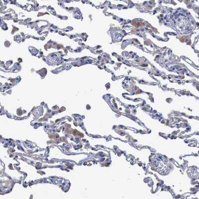 Immunohistochemistry-Paraffin: SVEP1 Antibody [NBP1-90791]