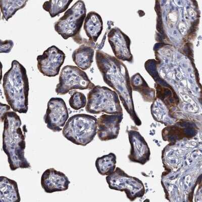Immunohistochemistry-Paraffin: SVEP1 Antibody [NBP1-90791]