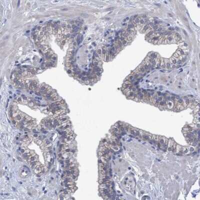 Immunohistochemistry-Paraffin: SVEP1 Antibody [NBP1-90791]
