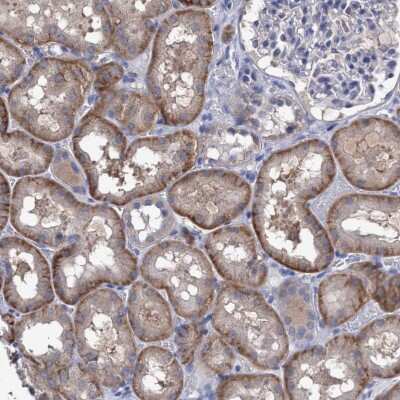 Immunohistochemistry-Paraffin: SVEP1 Antibody [NBP1-90791]