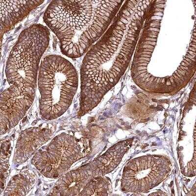 Immunohistochemistry-Paraffin: SVIP Antibody [NBP1-90561]