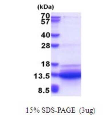 SDS-PAGE: Recombinant Human SVIP His Protein [NBP2-51646]