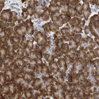 Immunohistochemistry-Paraffin: SVOP Antibody [NBP1-84104]