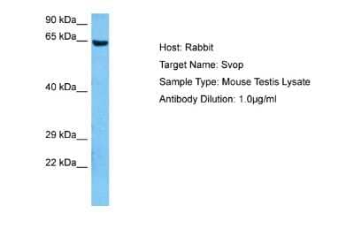 Western Blot: SVOP Antibody [NBP2-83607]