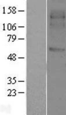 Western Blot: SVOP Overexpression Lysate [NBL1-16632]