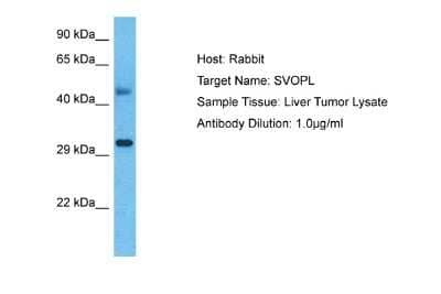 Western Blot: SVOPL Antibody [NBP2-83608]