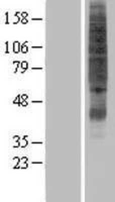 Western Blot: SVOPL Overexpression Lysate [NBP2-05086]