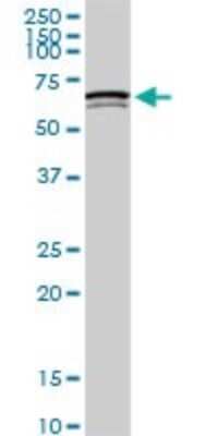 Western Blot: SWAP70 Antibody (3H8) [H00023075-M09]