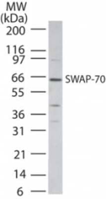 Western Blot: SWAP70 Antibody [NB100-56430]