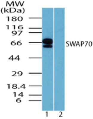 Western Blot: SWAP70 Antibody [NBP2-24654]