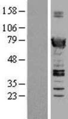 Western Blot: SWAP70 Overexpression Lysate [NBL1-16634]