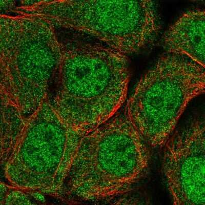 Immunocytochemistry/ Immunofluorescence: SWI5 Antibody [NBP2-30951]