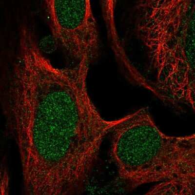 Immunocytochemistry/ Immunofluorescence: SWI5 Antibody [NBP2-56161]