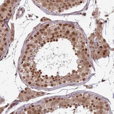 Immunohistochemistry-Paraffin: SWI5 Antibody [NBP2-30951]