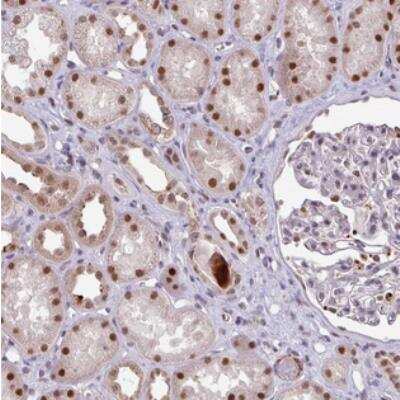 Immunohistochemistry: SWSAP1 Antibody [NBP2-30909]