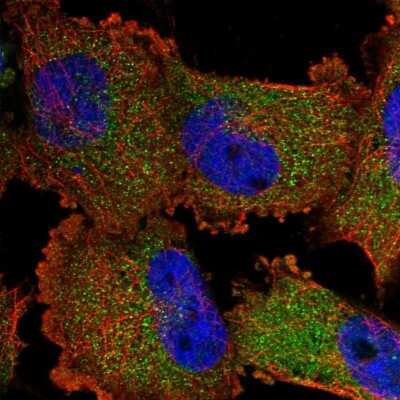 Immunocytochemistry/ Immunofluorescence: SWT1 Antibody [NBP1-90709]