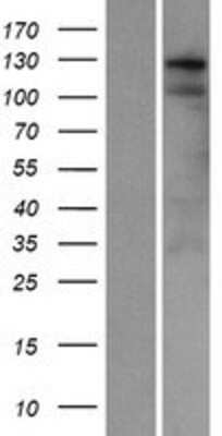 Western Blot: SWT1 Overexpression Lysate [NBP2-06946]