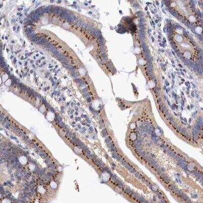 Immunohistochemistry-Paraffin: SYAP1 Antibody [NBP1-82230]