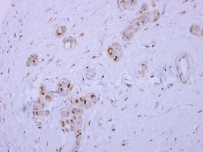 Immunohistochemistry-Paraffin: SYAP1 Antibody [NBP2-20541]