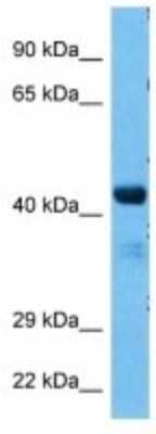 Western Blot: SYAP1 Antibody [NBP3-10169]