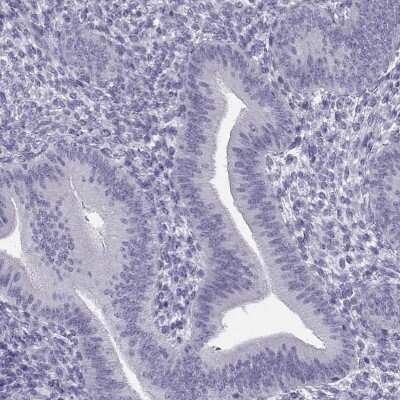 Immunohistochemistry-Paraffin: SYCE1 Antibody [NBP1-88971]