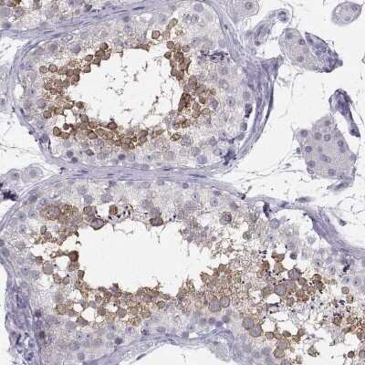 Immunohistochemistry-Paraffin: SYCE1 Antibody [NBP1-88971]