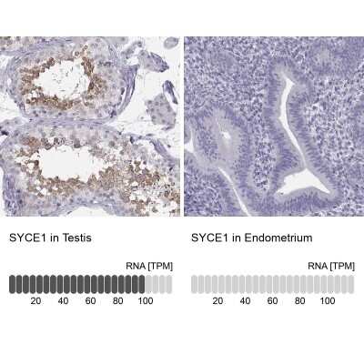 Immunohistochemistry-Paraffin: SYCE1 Antibody [NBP1-88971]