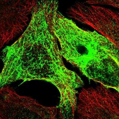 Immunocytochemistry/ Immunofluorescence: SYCE1L Antibody [NBP2-56331]