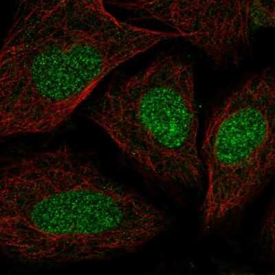 Immunocytochemistry/ Immunofluorescence: SYCE2 Antibody [NBP2-57063]